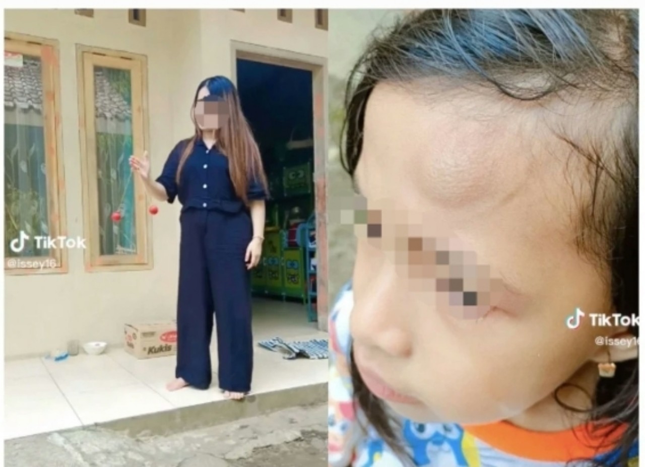 Viral, Bocah Jadi Korban Mainan Lato-Lato: Menangis Gegara Dahi Benjol