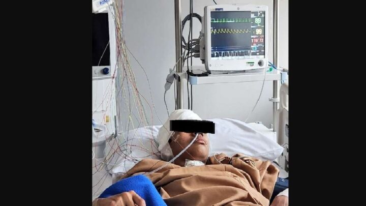 Disarankan Damai Dengan Mario Dandy, Ayah David Kecam Kajati DKI Jakarta mario dandy david