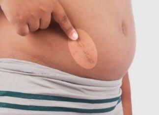 Waspada Penyakit Usus Buntu! Terutama Anak-Anak