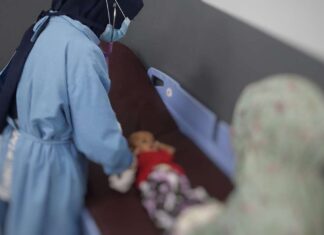 Bayi Gizi Buruk di Makassar, Pemerintah Buatkan KIS
