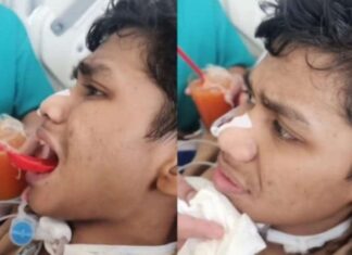 David Alami Cedera Berat di Kepala, Begini Kondisi Terbarunya