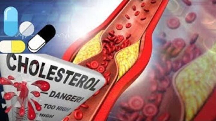 Takut Kolesterol? Berikut 5 Cara Menurunkan Kolesterol Tinggi kolesterol