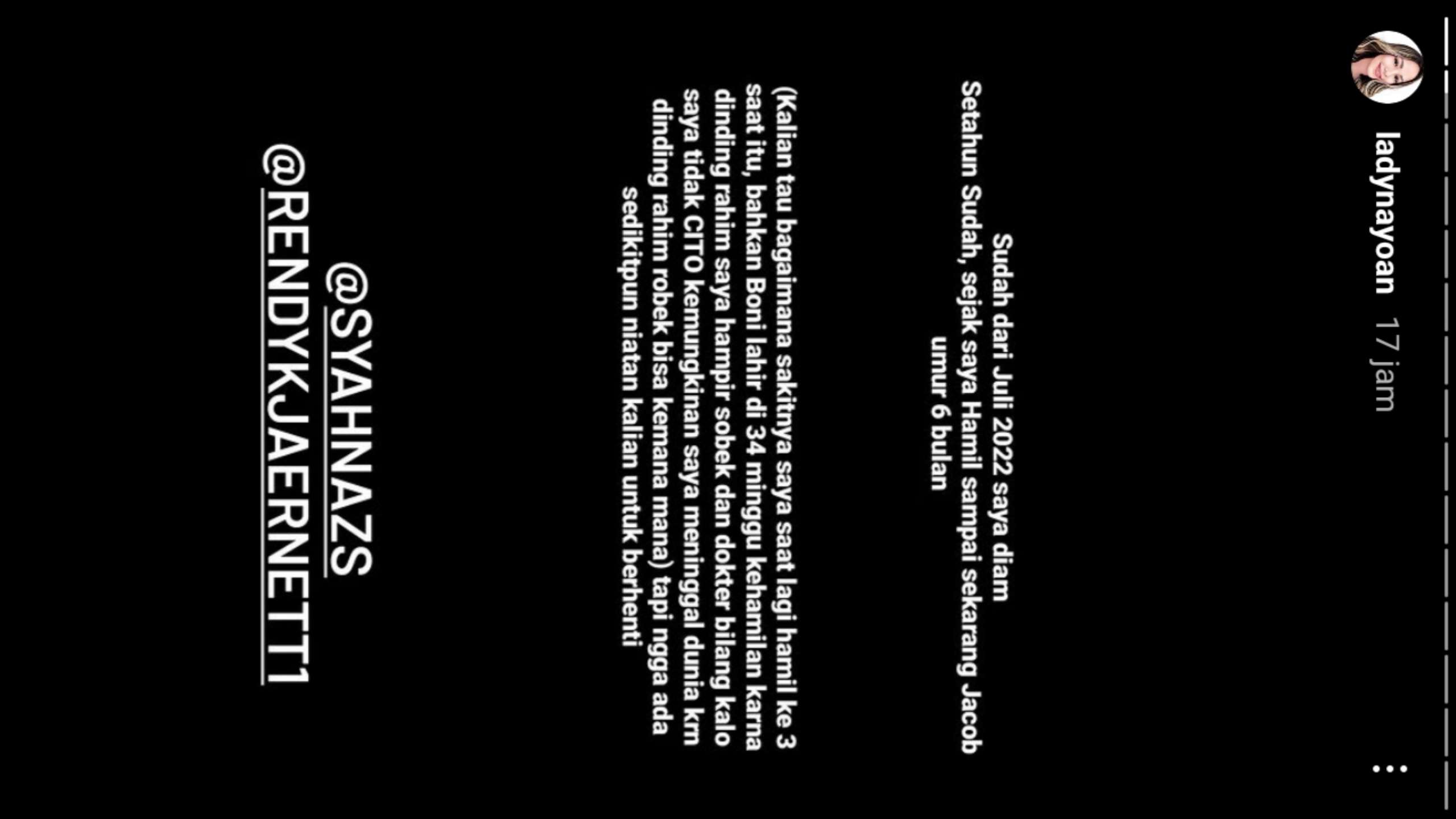 Dugaan Perselingkuhan Syahnaz dan Rendy Kjaernett Dibongkar Istri Sah: Sampai Kapan Mau Dirahasiakan?