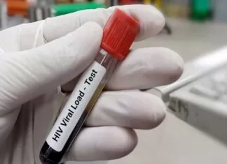 Empat Ribu Orang di Makassar Terkena HIV, Dorong Perda Tes HIV Sebelum Menikah