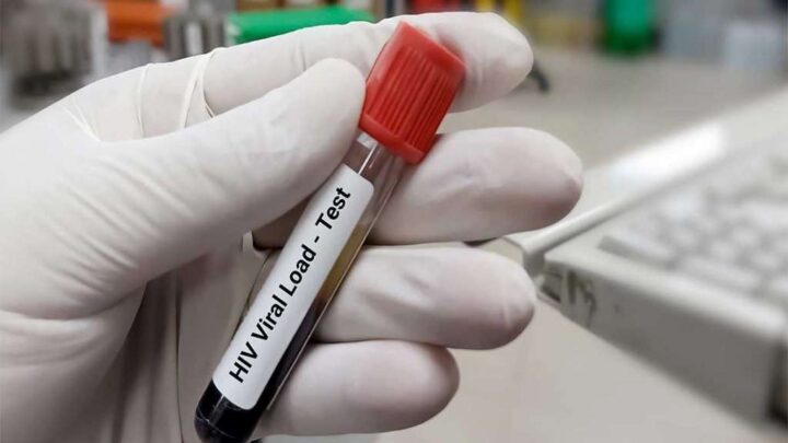 Empat Ribu Orang di Makassar Terkena HIV, Dorong Perda Tes HIV Sebelum Menikah Mitos HIV