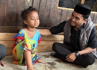 Sambangi Bocah Difabel