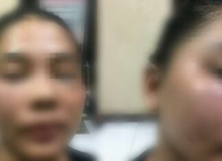 Dianiaya Hingga Babak Belur, Seorang Wanita Laporkan Oknum Polisi ke Polrestabes Makassar