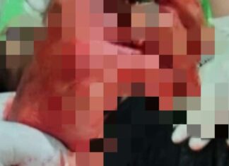 Aksi Baku Parang di Jeneponto, Satu Orang Meninggal Dunia dan Dua Orang Kritis