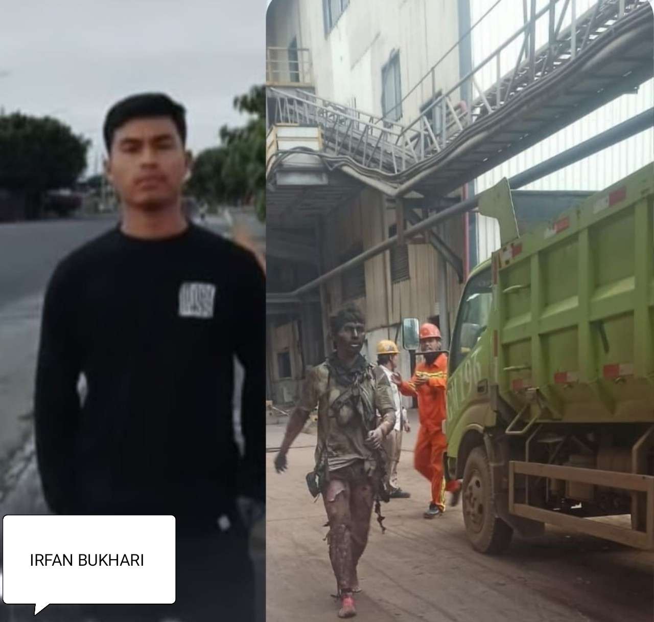 Innalillahi, Sempat Selamat Meski Tubuh Terbakar, Irfan Bukhari Korban Tungku Smelter IMIP Morowali Meninggal Dunia