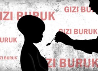 gizi buruk anak