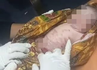 Bayi yang Ditemukan di Jeneponto Penuh Luka, Polisi Fokus Identifikasi Orang Tuanya