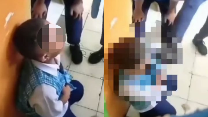 Keterbatasan Fisik, Siswa SMP di Makassar Jadi Korban Bully: Kepala Ditendang keterbatasan fisik