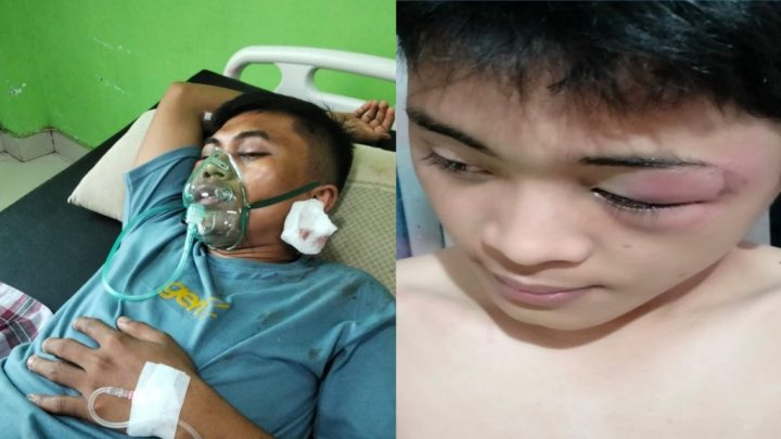 Dua orang Warga Desa Bulusibatang Jeneponto Dianiaya, Diduga Pelakunya Oknum Anggota Brimob Dua orang