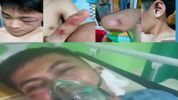 Kasus Penganiayaan di Tina'ro Desa Kareloe Jeneponto Diduga Lain yang Berulah, Lain yang Dianiaya Kasus Penganiayaan