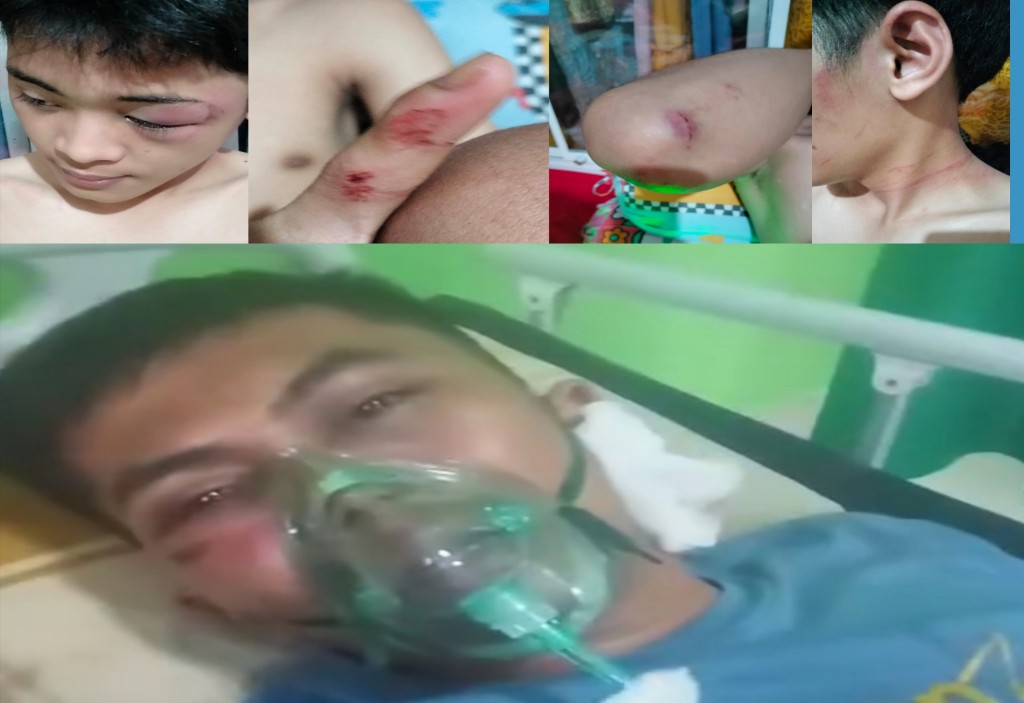 LBH Bhakti Keadilan Kawal Kasus Penganiayaan di Tina’ro Jeneponto