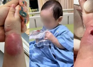 Klarifikasi RSIA Paramount Makassar Soal Isu Tangan Bayi Bengkak Akibat Infus